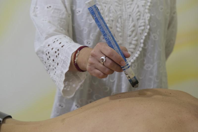 Acupuntura Vale Moxibustion Albacete